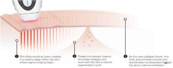 Age-defying Laser + Antioxidant System and how it works