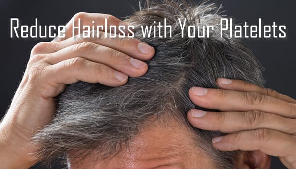 Platelet Rich Plasma Therapy for Hair Loss